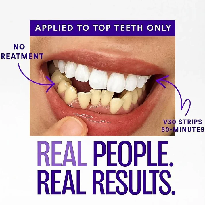 Purple Whitening Strips